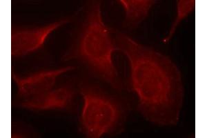 Immunofluorescence staining of methanol-fixed Hela cells using BIM(Phospho-Ser69) Antibody. (BIM 抗体  (pSer69))