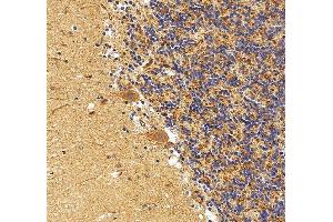 IHC analysis of FLT3 using anti-FLT3 antibody (ABIN7602257). (FLT3 抗体  (AA 66-993))