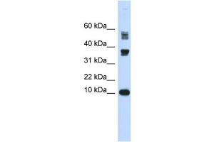 WB Suggested Anti-FABP3 Antibody Titration:  0. (FABP3 抗体  (Middle Region))