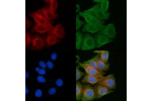 ABIN6259315 and ABIN6274430 staining Hela cells(45 min of heat-shock) by IF/ICC. (RGAG1 抗体)