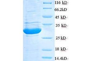Immunohistochemistry (IHC) image for phospholipase A2, Group V (PLA2G5) (AA 21-137) protein (His tag) (ABIN7585554)