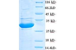 phospholipase A2, Group V (PLA2G5) (AA 21-137) protein (His tag) expressed in E. (PLA2G5 Protein (AA 21-137) (His tag))