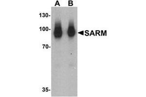 Western blot analysis of SARM in human kidney tissue lysate with SARM Antibody  at (A) 1 and (B) 2 ug/mL. (SARM1 抗体  (N-Term))