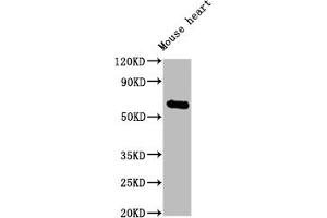 Western Blot Positive WB detected in: Mouse heart tissue All lanes: Ces1c antibody at 1:2000 Secondary Goat polyclonal to rabbit IgG at 1/50000 dilution Predicted band size: 62 kDa Observed band size: 62 kDa
