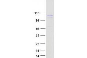 Western Blotting (WB) image for Peptidylglycine alpha-Amidating Monooxygenase (PAM) (Transcript Variant 3) (Active) protein (Myc-DYKDDDDK Tag) (ABIN2728195)