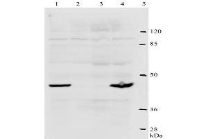 Western-Blot analysis of HPV-18 E2 protein. (Human Papilloma Virus 18 E2 (HPV-18 E2) (AA 1-83) 抗体)
