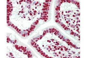 Anti-HNRNPH1 / HnRNP H antibody IHC staining of human small intestine.