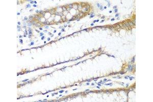 Immunohistochemistry of paraffin-embedded Human stomach using PPP4R1 Polyclonal Antibody at dilution of 1:100 (40x lens). (PPP4R1 抗体)