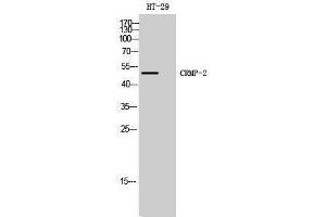 Western Blotting (WB) image for anti-Dihydropyrimidinase-Like 2 (DPYSL2) (Ser308) antibody (ABIN3184089) (DPYSL2 抗体  (Ser308))