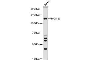 Western blot analysis of extracts of Jurkat cells, using MCM10 antibody (ABIN6129654, ABIN6143639, ABIN6143641 and ABIN6223024) at 1:500 dilution. (MCM10 抗体  (AA 616-875))