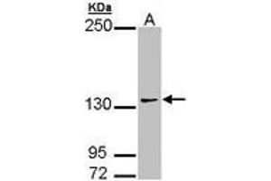 Image no. 2 for anti-Autism Susceptibility Candidate 2 (AUTS2) (AA 524-770) antibody (ABIN467523) (AUTS2 抗体  (AA 524-770))