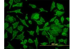 Immunofluorescence of monoclonal antibody to TPT1 on HeLa cell. (TPT1 抗体  (AA 35-138))
