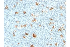 Formalin-fixed, paraffin-embedded human tonsil stained with Calgranulin B Monoclonal Antibody (CAGB/426) (S100A9 抗体)