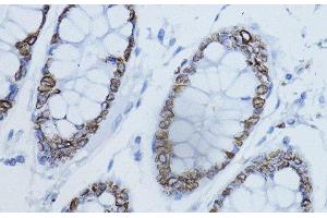 Immunohistochemistry of paraffin-embedded Human colon using LMNB1 Polyclonal Antibody at dilution of 1:200 (40x lens). (Lamin B1 抗体)