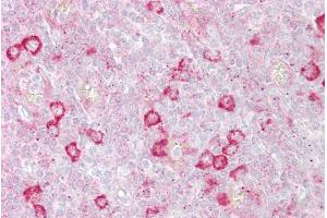 Immunohistochemistry with Tonsil tissue at an antibody concentration of 5µg/ml using anti-RHOD antibody (ARP42414_P050) (RHOD 抗体  (C-Term))