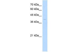 WB Suggested Anti-MKX Antibody Titration: 0. (MKX 抗体  (Middle Region))