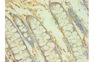 Immunohistochemistry of paraffin-embedded human colon tissue using ABIN7145745 at dilution of 1:100 (BCAT2 抗体  (AA 20-200))