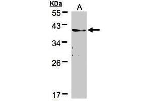 WB Image Sample(30 μg of whole cell lysate) A:A431, 12% SDS PAGE antibody diluted at 1:500 (TMEM59 抗体)