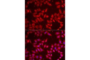 Immunofluorescence analysis of MCF7 cells using BAP1 antibody. (BAP1 抗体  (AA 460-729))