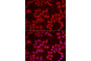 Immunofluorescence analysis of MCF7 cells using BAP1 antibody. (BAP1 抗体  (AA 460-729))