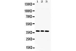Western blot analysis of LDHB expression in rat brain extract ( Lane 1), NIH3T3 whole cell lysates ( Lane 2) and U2OS whole cell lysates ( Lane 3).