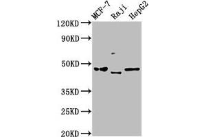 Western Blot Positive WB detected in: MCF-7 whole cell lysate, Raji whole cell lysate, HepG2 whole cell lysate All lanes: SERPINA11 antibody at 5 μg/mL Secondary Goat polyclonal to rabbit IgG at 1/50000 dilution Predicted band size: 47 kDa Observed band size: 47 kDa (SERPINA11 抗体  (AA 279-394))