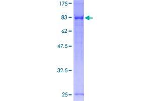 PPP1R16A Protein (AA 1-528) (GST tag)