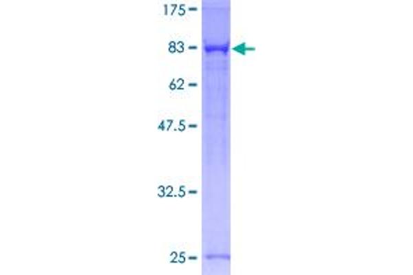 PPP1R16A Protein (AA 1-528) (GST tag)