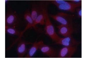 Immunofluorescence staining of methanol-fixed MEF cells using PKM2 (phospho-Ser37) Antibody. (PKM 抗体  (pSer37))