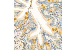 Immunohistochemistry (Paraffin-embedded Sections) (IHC (p)) image for anti-Chloride Channel Accessory 1 (CLCA1) antibody (ABIN7073472)