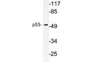 Western blot analysis of p53 antibody in extracts from COS7 cells. (p53 抗体)