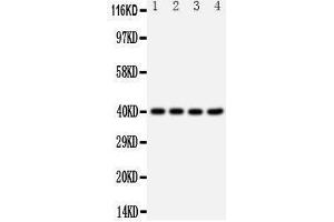 Western Blotting (WB) image for anti-Chemokine (C-X-C Motif) Receptor 1 (CXCR1) (AA 24-38), (N-Term) antibody (ABIN3042912) (CXCR1 抗体  (N-Term))