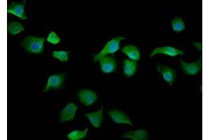 Immunofluorescence staining of A549 cells with ABIN7167931 at 1:200, counter-stained with DAPI. (ARHGAP15 抗体  (AA 1-154))