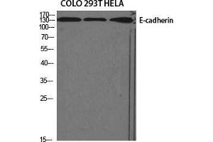 Western Blot (WB) analysis of specific cells using E-cadherin Polyclonal Antibody. (E-cadherin 抗体  (N-Term))