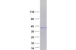 Western Blotting (WB) image for T-Cell Leukemia Homeobox 3 (TLX3) protein (Myc-DYKDDDDK Tag) (ABIN2733825)