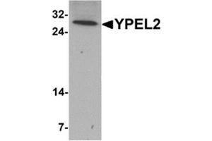 Western blot analysis of YPEL2 in HeLa cell lysate with YPEL2 antibody at 1 ug/mL. (YPEL2 抗体  (N-Term))