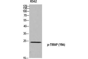Western Blot (WB) analysis of K562 using p-TIRAP (Y86) antibody. (TIRAP 抗体  (pTyr86))