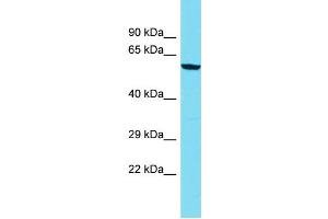 Host: Rabbit  Target Name: Zcchc8  Sample Tissue: Rat Thymus lysates  Antibody Dilution: 1. (ZCCHC8 抗体  (C-Term))
