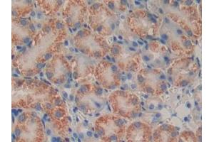 Immunohistochemistry (IHC) image for anti-Proteasome (Prosome, Macropain) Subunit, beta Type, 9 (Large Multifunctional Peptidase 2) (PSMB9) (AA 22-219) antibody (ABIN7442633)