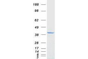 Western Blotting (WB) image for Zinc Finger Protein 397 (ZNF397) (Transcript Variant 2) protein (Myc-DYKDDDDK Tag) (ABIN2736041)