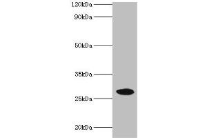Western blot All lanes: NMNAT3 antibody at 2 μg/mL + Mouse brain tissue Secondary Goat polyclonal to rabbit IgG at 1/10000 dilution Predicted band size: 29, 25, 19 kDa Observed band size: 29 kDa