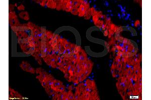 Formalin-fixed and paraffin embedded rat heart tissue labeled with Rabbit Anti-DOG-1/TMEM16A Polyclonal Antibody, Unconjugated (ABIN704216) at 1:200 followed by conjugation to the secondary antibody and DAB staining. (ANO1 抗体  (AA 151-250))