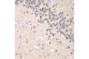 Immunohistochemistry of paraffin-embedded rat brain using CCNC antibody. (Cyclin C 抗体  (AA 1-283))