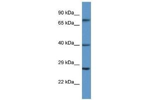 Western Blotting (WB) image for anti-Angiotensin II Receptor, Type 2 (AGTR2) (N-Term) antibody (ABIN929413)