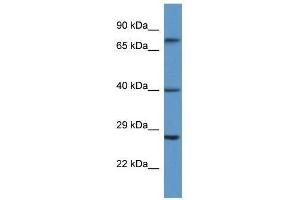 Western Blot showing AGTR2 antibody used at a concentration of 1. (Angiotensin II Type 2 Receptor 抗体  (N-Term))