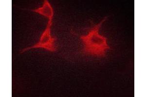 ABIN6267329 staining HeLa cells by ICC/IF. (beta 2 Adrenergic Receptor 抗体  (pSer346))