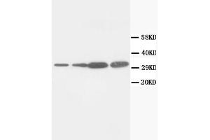 Western Blotting (WB) image for anti-Proliferating Cell Nuclear Antigen (PCNA) antibody (ABIN1108598) (PCNA 抗体)