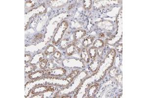 Immunohistochemical staining of human kidney with SLC15A1 polyclonal antibody  shows moderate cytoplasmic positivity in distal tubules. (SLC15A1 抗体)