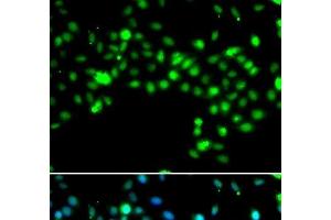 Immunofluorescence analysis of MCF-7 cells using SRSF4 Polyclonal Antibody (SRSF4 抗体)