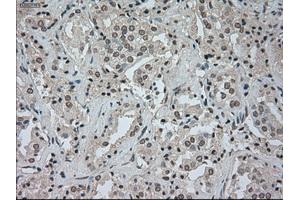Image no. 2 for anti-Cancer/testis Antigen 1B (CTAG1B) antibody (ABIN1499899) (CTAG1B 抗体)